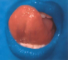 Blue Lipps